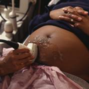 Expectant mother receiving an ultrasound